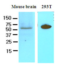 DACT3 Antibody - Cell lysates of mouse brain and 293T (50 ug) were resolved by SDS-PAGE, transferred to NC membrane and probed with anti-human DACT3 (1:250). Proteins were visualized using a goat anti-mouse secondary antibody conjugated to HRP and an ECL detection system.