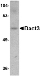 DACT3 Antibody - Western blot of Dact3 in rat brain tissue lysate with Dact3 antibody at 1 ug/ml