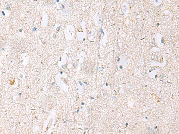 DACT3 Antibody - Immunohistochemistry of paraffin-embedded Human brain tissue  using DACT3 Polyclonal Antibody at dilution of 1:55(×200)