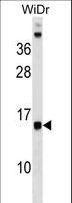 DAD1 Antibody - DAD1 Antibody western blot of WiDr cell line lysates (35 ug/lane). The DAD1 antibody detected the DAD1 protein (arrow).