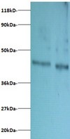 DAD1 Antibody - Western blot of Dolichyl-diphosphooligosaccharide-protein glycosyltransferase subunit DAD1 antibody at 2 ug/ml. Lane 1: EC109 whole cell lysate. Lane 2: 293T whole cell lysate. Secondary: Goat polyclonal to Rabbit IgG at 1:15000 dilution. Predicted band size: 12. 4 kDa. Observed band size: 40 kDa.  This image was taken for the unconjugated form of this product. Other forms have not been tested.