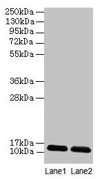 DAD1 Antibody - Western blot All lanes: Dolichyl-diphosphooligosaccharide-protein glycosyltransferase subunit DAD1 antibody at 2µg/ml Lane 1: EC109 whole cell lysate Lane 2: 293T whole cell lysate Secondary Goat polyclonal to rabbit IgG at 1/15000 dilution Predicted band size: 12 .4 kDa Observed band size: 12.4 kDa