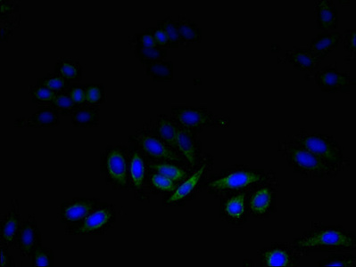DAD1 Antibody - Immunofluorescent analysis of HepG2 cells using DAD1 Antibody at dilution of 1:100 and Alexa Fluor 488-congugated AffiniPure Goat Anti-Rabbit IgG(H+L)