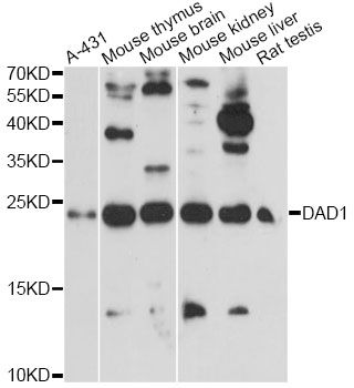 DAD1 Antibody - Western blot analysis of extracts of various cell lines, using DAD1 antibody at 1:1000 dilution. The secondary antibody used was an HRP Goat Anti-Rabbit IgG (H+L) at 1:10000 dilution. Lysates were loaded 25ug per lane and 3% nonfat dry milk in TBST was used for blocking. An ECL Kit was used for detection and the exposure time was 5min.