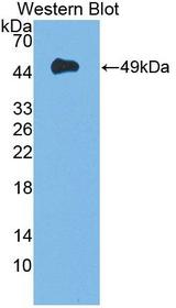 DAG1 / Dystroglycan Antibody - Western blot of DAG1 / Dystroglycan antibody.