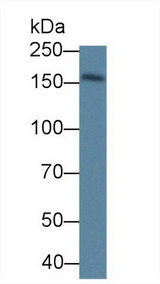 DAG1 / Dystroglycan Antibody - Western Blot; Sample: Mouse Skeletal muscle lysate; Primary Ab: 1µg/ml Rabbit Anti-Mouse DAG1 Antibody Second Ab: 0.2µg/mL HRP-Linked Caprine Anti-Rabbit IgG Polyclonal Antibody