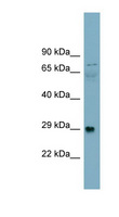 DAG1 / Dystroglycan Antibody - DAG1 / Dystroglycan antibody Western blot of Fetal Stomach lysate. This image was taken for the unconjugated form of this product. Other forms have not been tested.