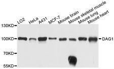 DAG1 / Dystroglycan Antibody - Western blot analysis of extracts of various cell lines, using DAG1 antibody at 1:1000 dilution. The secondary antibody used was an HRP Goat Anti-Rabbit IgG (H+L) at 1:10000 dilution. Lysates were loaded 25ug per lane and 3% nonfat dry milk in TBST was used for blocking. An ECL Kit was used for detection and the exposure time was 5s.