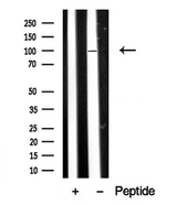 DAG1 / Dystroglycan Antibody - Western blot analysis of extracts of human skeletal muscle tissue sample using DAG1 antibody.