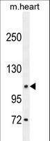 DAGLA Antibody - DAGLA Antibody western blot of mouse heart tissue lysates (35 ug/lane). The DAGLA antibody detected the DAGLA protein (arrow).
