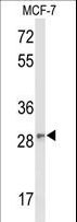 DAGLB Antibody - Western blot of DAGLB Antibody in MCF-7 cell line lysates (35 ug/lane). DAGLB (arrow) was detected using the purified antibody;