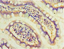 DAND5 Antibody - Immunohistochemistry of paraffin-embedded human small intestine using antibody at 1:100 dilution.  This image was taken for the unconjugated form of this product. Other forms have not been tested.