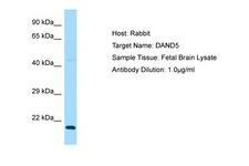 DAND5 Antibody -  This image was taken for the unconjugated form of this product. Other forms have not been tested.