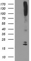 DAND5 Antibody - HEK293T cells were transfected with the pCMV6-ENTRY control (Left lane) or pCMV6-ENTRY DAND5 (Right lane) cDNA for 48 hrs and lysed. Equivalent amounts of cell lysates (5 ug per lane) were separated by SDS-PAGE and immunoblotted with anti-DAND5.