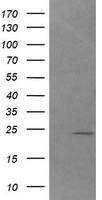 DAND5 Antibody - HEK293T cells were transfected with the pCMV6-ENTRY control (Left lane) or pCMV6-ENTRY DAND5 (Right lane) cDNA for 48 hrs and lysed. Equivalent amounts of cell lysates (5 ug per lane) were separated by SDS-PAGE and immunoblotted with anti-DAND5.