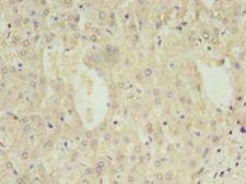 DAO / D Amino Acid Oxidase Antibody - Immunohistochemistry of paraffin-embedded human liver tissue using antibody at 1:100 dilution.  This image was taken for the unconjugated form of this product. Other forms have not been tested.