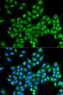 DAO / D Amino Acid Oxidase Antibody - Immunofluorescence analysis of MCF-7 cells.