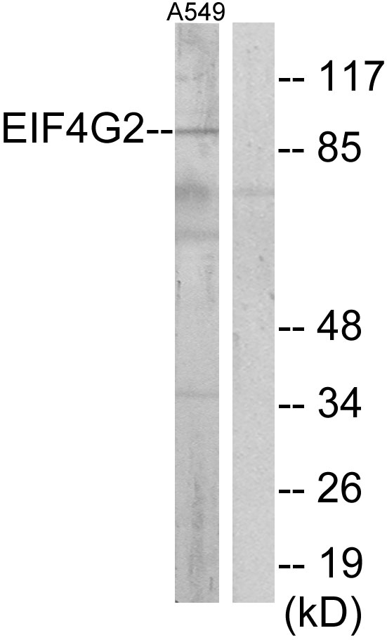 DAP-5 / EIF4G2 Antibody - Western blot analysis of lysates from A549 cells, using EIF4G2 Antibody. The lane on the right is blocked with the synthesized peptide.