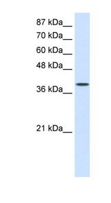 DAP-5 / EIF4G2 Antibody - EIF4G2 antibody Western blot of HepG2 cell lysate. This image was taken for the unconjugated form of this product. Other forms have not been tested.