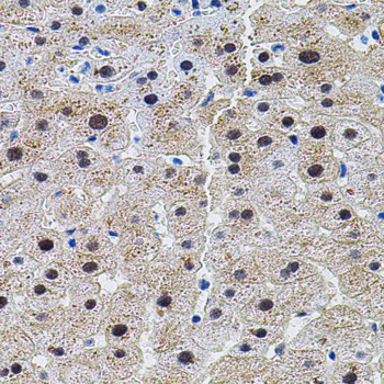 DAP-5 / EIF4G2 Antibody - Immunohistochemistry of paraffin-embedded human liver injury tissue.