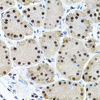 DAP-5 / EIF4G2 Antibody - Immunohistochemistry of paraffin-embedded human stomach tissue.