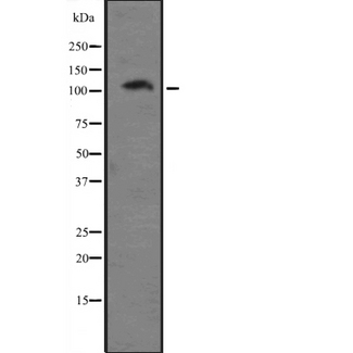 DAP-5 / EIF4G2 Antibody - Western blot analysis of EIF4G2 expression in A431 whole cells lysate. The lane on the left is treated with the antigen-specific peptide.