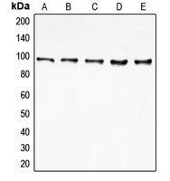 DAP-5 / EIF4G2 Antibody - Western blot analysis of EIF4G2 expression in MCF7 (A); HeLa (B); K562 (C); Jurkat (D); HepG2 (E) whole cell lysates.