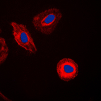 DAP-5 / EIF4G2 Antibody - Immunofluorescent analysis of EIF4G2 staining in HeLa cells. Formalin-fixed cells were permeabilized with 0.1% Triton X-100 in TBS for 5-10 minutes and blocked with 3% BSA-PBS for 30 minutes at room temperature. Cells were probed with the primary antibody in 3% BSA-PBS and incubated overnight at 4 C in a humidified chamber. Cells were washed with PBST and incubated with a DyLight 594-conjugated secondary antibody (red) in PBS at room temperature in the dark. DAPI was used to stain the cell nuclei (blue).
