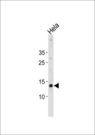 DAP Antibody - DAP Antibody western blot of HeLa cell line lysates (35 ug/lane). The DAP antibody detected the DAP protein (arrow).