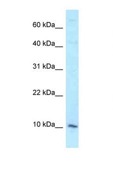 DAP Antibody - DAP antibody Western blot of HCT15 Cell lysate. Antibody concentration 1 ug/ml.  This image was taken for the unconjugated form of this product. Other forms have not been tested.
