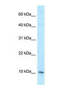 DAP Antibody - DAP antibody Western blot of HCT15 Cell lysate. Antibody concentration 1 ug/ml.  This image was taken for the unconjugated form of this product. Other forms have not been tested.