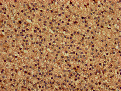 DAP Antibody - IHC image of DAP Antibody diluted at 1:150 and staining in paraffin-embedded human adrenal gland tissue performed on a Leica BondTM system. After dewaxing and hydration, antigen retrieval was mediated by high pressure in a citrate buffer (pH 6.0). Section was blocked with 10% normal goat serum 30min at RT. Then primary antibody (1% BSA) was incubated at 4°C overnight. The primary is detected by a biotinylated secondary antibody and visualized using an HRP conjugated SP system.