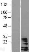 DAP10 Protein - Western validation with an anti-DDK antibody * L: Control HEK293 lysate R: Over-expression lysate