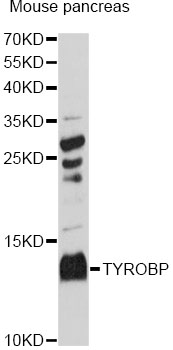 DAP12 Antibody - Western blot analysis of extracts of mouse pancreas, using TYROBP antibody at 1:3000 dilution. The secondary antibody used was an HRP Goat Anti-Rabbit IgG (H+L) at 1:10000 dilution. Lysates were loaded 25ug per lane and 3% nonfat dry milk in TBST was used for blocking. An ECL Kit was used for detection and the exposure time was 90s.