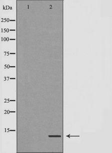 DAP12 Antibody - Western blot analysis of extracts of SK-SEP1 using TYROBP antibody. The lane on the left is treated with the antigen-specific peptide.