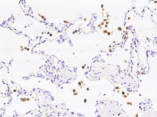 DAP12 Antibody - Immunochemical staining of human TYROBP in human lung with rabbit polyclonal antibody at 1:500 dilution, formalin-fixed paraffin embedded sections.
