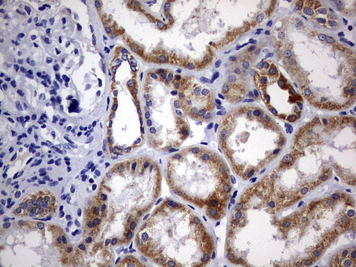 DAP3 Antibody - IHC of paraffin-embedded Human Kidney tissue using anti-DAP3 mouse monoclonal antibody. (Heat-induced epitope retrieval by 10mM citric buffer, pH6.0, 120°C for 3min).