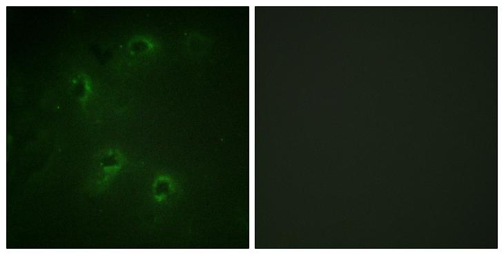 DAPK1 / DAP Kinase Antibody - Peptide - + Immunofluorescence analysis of COS-7 cells, using DAPK1 antibody.