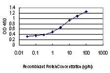 DAPK1 / DAP Kinase Antibody - Detection limit for recombinant GST tagged DAPK1 is approximately 0.1 ng/ml as a capture antibody.