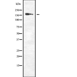 DAPK1 / DAP Kinase Antibody - Western blot analysis of DAPK1 using Jurkat whole cells lysates