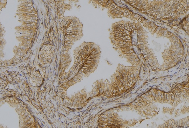 DAPK1 / DAP Kinase Antibody - 1:100 staining mouse colon tissue by IHC-P. The sample was formaldehyde fixed and a heat mediated antigen retrieval step in citrate buffer was performed. The sample was then blocked and incubated with the antibody for 1.5 hours at 22°C. An HRP conjugated goat anti-rabbit antibody was used as the secondary.