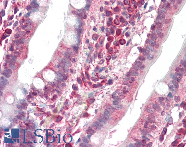 DAPK1 / DAP Kinase Antibody - Human Small Intestine: Formalin-Fixed, Paraffin-Embedded (FFPE).  This image was taken for the unconjugated form of this product. Other forms have not been tested.