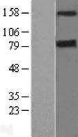 DAPK1 / DAP Kinase Protein - Western validation with an anti-DDK antibody * L: Control HEK293 lysate R: Over-expression lysate