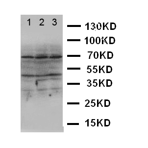 DAPK2 / DAP Kinase 2 Antibody - WB of DAPK2 / DRP1 antibody. Lane 1: U87 Cell Lysate. Lane 2: MCF-7 Cell Lysate. Lane 3: SMMC Cell Lysate.