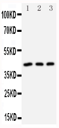 DAPK2 / DAP Kinase 2 Antibody - Anti-DAP Kinase 2 antibody, Western blotting All lanes: Anti DAP Kinase 2 at 0.5ug/ml Lane 1: U87 Whole Cell Lysate at 40ug Lane 2: MCF-7 Whole Cell Lysate at 40ug Lane 3: SMMC Whole Cell Lysate at 40ug Predicted bind size: 43KD Observed bind size: 43KD