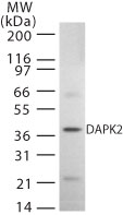 DAPK2 / DAP Kinase 2 Antibody - Western blot of DAPK2 in rat kidney whole cell lysate using antibody at 2 ug/ml.
