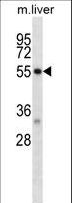 DAPK2 / DAP Kinase 2 Antibody - Mouse Dapk2 Antibody western blot of mouse liver tissue lysates (35 ug/lane). The Dapk2 antibody detected the Dapk2 protein (arrow).