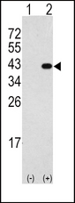 DAPK2 / DAP Kinase 2 Antibody - Western blot of DAPK2(arrow) using rabbit polyclonal DAPK2 Antibody. 293 cell lysates (2 ug/lane) either nontransfected (Lane 1) or transiently transfected with the DAPK2 gene (Lane 2) (Origene Technologies).