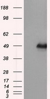 DAPK2 / DAP Kinase 2 Antibody - HEK293T cells were transfected with the pCMV6-ENTRY control (Left lane) or pCMV6-ENTRY DAPK2 (Right lane) cDNA for 48 hrs and lysed. Equivalent amounts of cell lysates (5 ug per lane) were separated by SDS-PAGE and immunoblotted with anti-DAPK2.