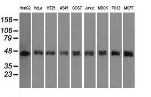 DAPK2 / DAP Kinase 2 Antibody - WB analysis of extracts (35ug) from 9 different cell lines by using anti-DAPK2 monoclonal antibody.